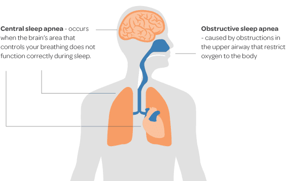 Sleep Apnea: Causes, Symptoms, & Treatments 1
